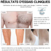 Epilateur laser permanent IPL visage et corps - Couleurs Lagon
