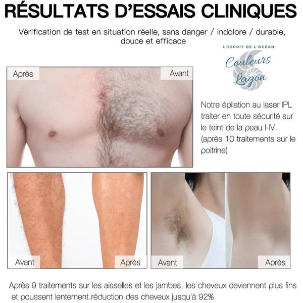 Epilateur laser permanent IPL visage et corps - Couleurs Lagon