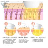 Epilateur laser permanent IPL visage et corps - Couleurs Lagon